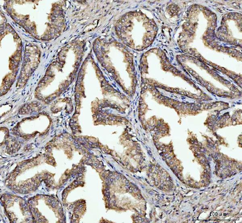 GSDMD Rabbit Polyclonal Antibody