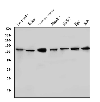 HDAC9 Rabbit Polyclonal Antibody