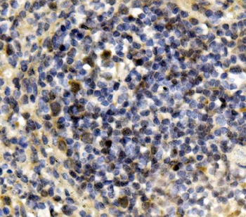 IRF3 Rabbit Polyclonal Antibody