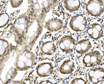 ITCH/AIP4 Rabbit Polyclonal Antibody