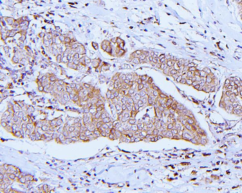 ApoER2/LRP8 Antibody