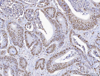 MCM6 Rabbit Polyclonal Antibody