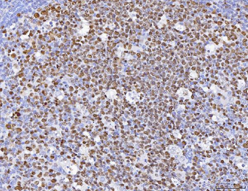 MCM6 Rabbit Polyclonal Antibody