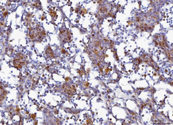 MCM6 Rabbit Polyclonal Antibody