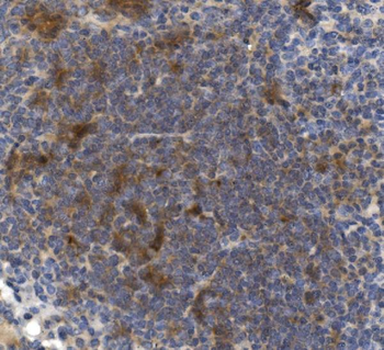 CD73/Nt5e Rabbit Polyclonal Antibody