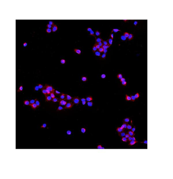 PDE6 beta/PDE6B Rabbit Polyclonal Antibody