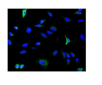 PDE6 beta/PDE6B Rabbit Polyclonal Antibody