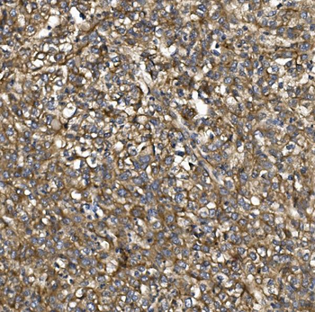 PDE6 beta/PDE6B Rabbit Polyclonal Antibody