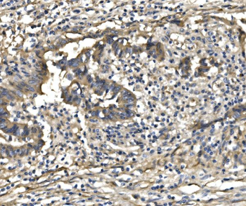 PDE6 beta/PDE6B Rabbit Polyclonal Antibody