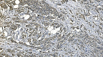 PNPT1 Rabbit Polyclonal Antibody