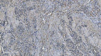 PNPT1 Rabbit Polyclonal Antibody