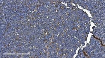 PNPT1 Rabbit Polyclonal Antibody