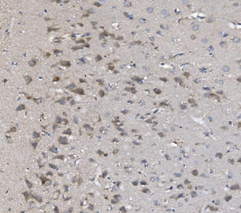 PNPT1 Rabbit Polyclonal Antibody