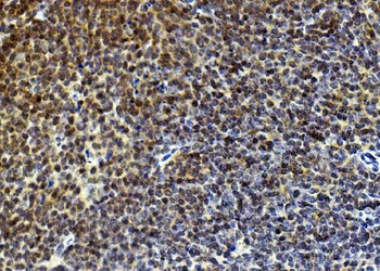 Rad9/Rad9a Rabbit Polyclonal Antibody