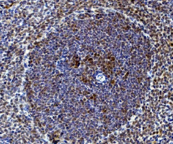 Rad9/Rad9a Rabbit Polyclonal Antibody