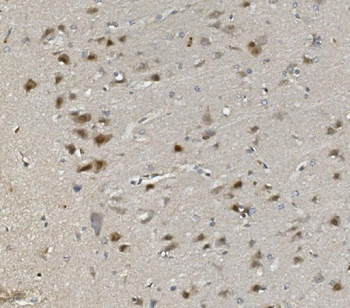 Rad9b Rabbit Polyclonal Antibody