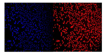 RCC1 Rabbit Polyclonal Antibody