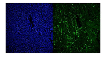 RCC1 Rabbit Polyclonal Antibody