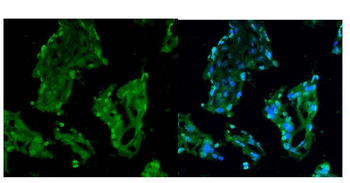 RCC1 Rabbit Polyclonal Antibody