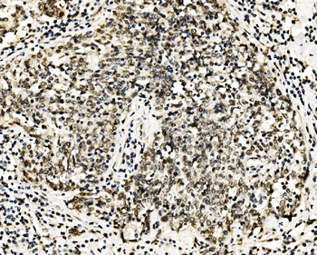 RCC1 Rabbit Polyclonal Antibody