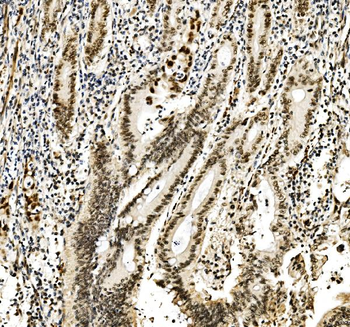 RCC1 Rabbit Polyclonal Antibody
