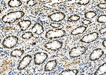 RCC1 Rabbit Polyclonal Antibody