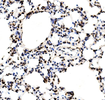 RCC1 Rabbit Polyclonal Antibody