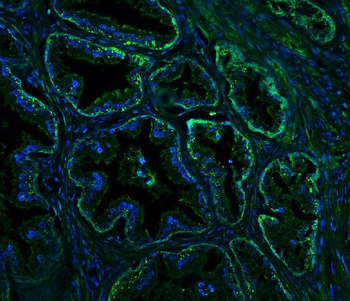 Nogo A/RTN4 Rabbit Polyclonal Antibody