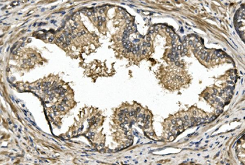 Nogo A/RTN4 Rabbit Polyclonal Antibody