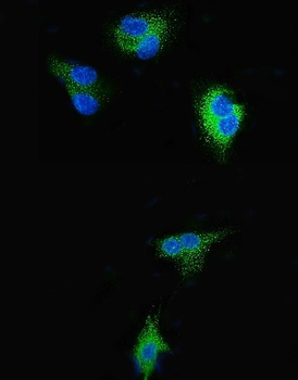 SGK1 Rabbit Polyclonal Antibody