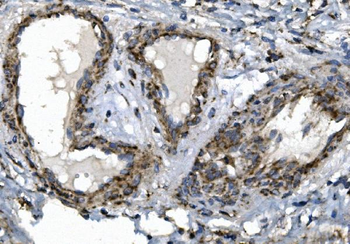 SGK1 Rabbit Polyclonal Antibody