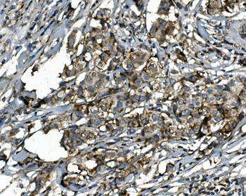 SGK1 Rabbit Polyclonal Antibody