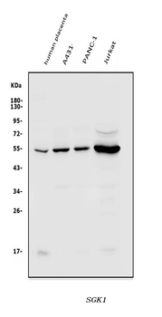 SGK1 Rabbit Polyclonal Antibody