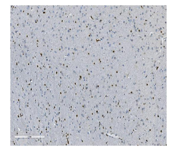 Transketolase/TKT Antibody