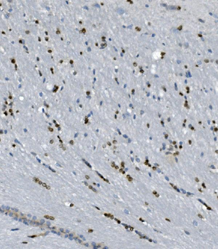 Transketolase/TKT Antibody