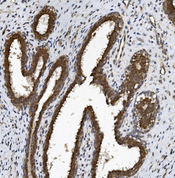 BCRP/ABCG2 Rabbit Polyclonal Antibody