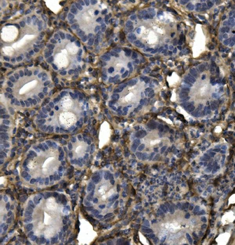 AKAP12 Rabbit Polyclonal Antibody