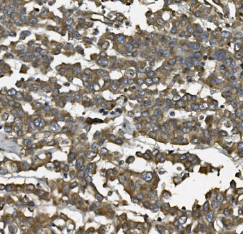 ALDH1L1 Antibody