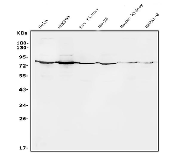 Alkaline phosphatase/ALPL Rabbit Polyclonal Antibody