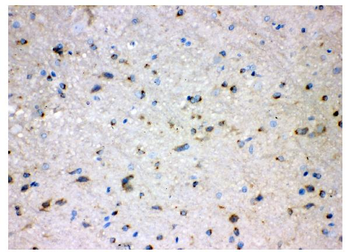 Alkaline phosphatase/ALPL Rabbit Polyclonal Antibody