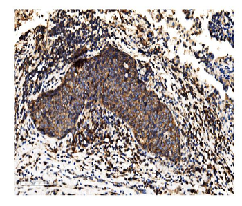 Alkaline phosphatase/ALPL Rabbit Polyclonal Antibody