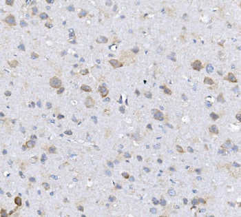 Alkaline phosphatase/ALPL Rabbit Polyclonal Antibody