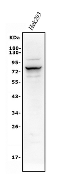 Alkaline phosphatase/ALPL Rabbit Polyclonal Antibody