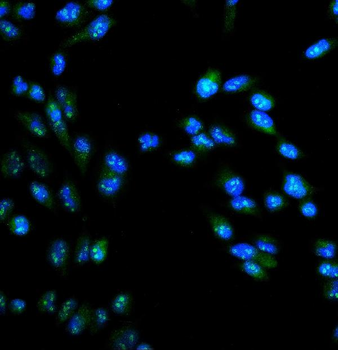 ARG2 Rabbit Polyclonal Antibody