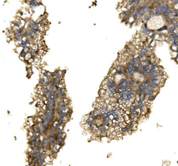 ARG2 Rabbit Polyclonal Antibody