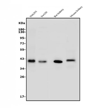 ARG2 Rabbit Polyclonal Antibody