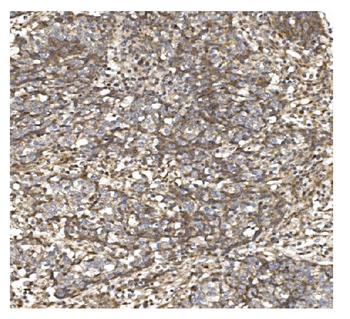 BDH1 Rabbit Polyclonal Antibody