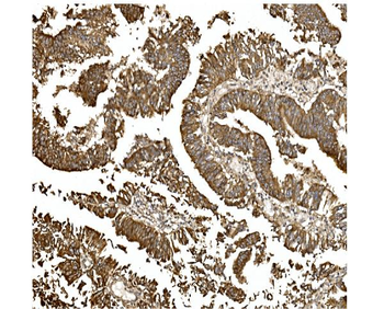BDH1 Rabbit Polyclonal Antibody