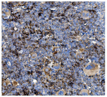 CD82 Rabbit Polyclonal Antibody