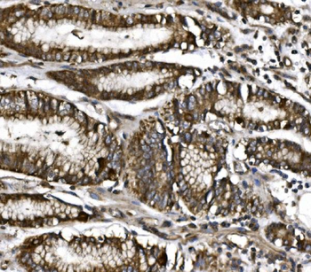 MitoNEET/CISD1 Antibody